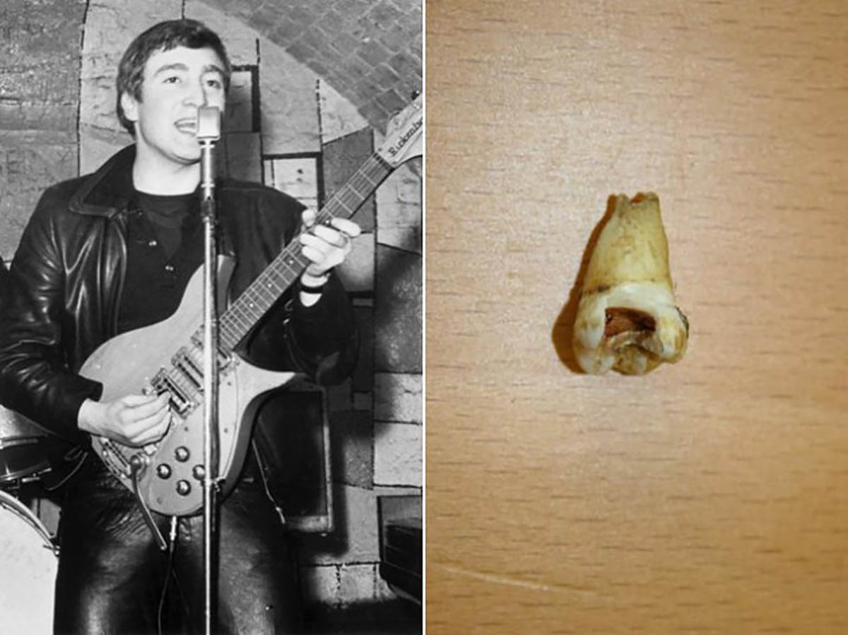 John Lennon's tooth