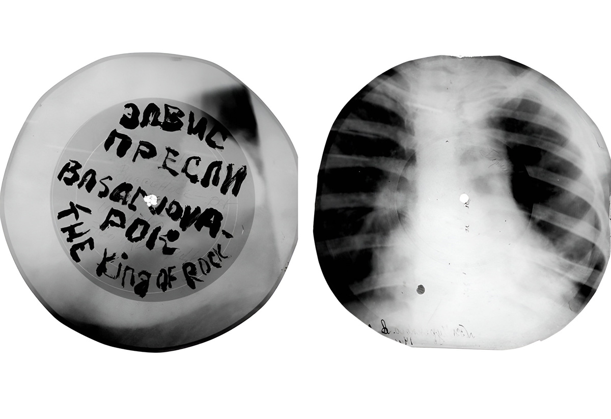 Placa de una imagen de rayos X